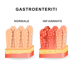 Gastroenteriti