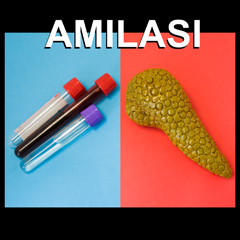 Amilasi