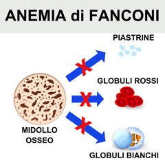 Anemia di Fanconi