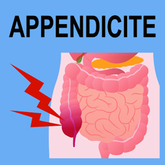 Appendicite