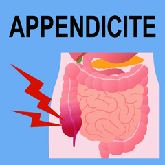 appendicite