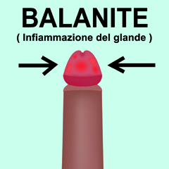 Balanite