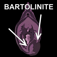 Bartolinite