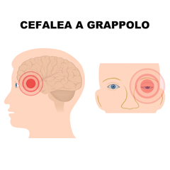 Cefalea a grappolo