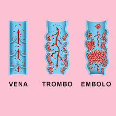 Coagulo, trombo, embolo