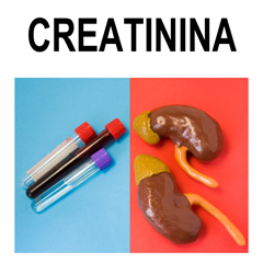 Creatinina