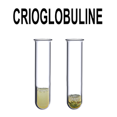 Crioglobuline