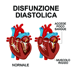 Disfunzione diastolica