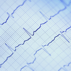 ECG - Elettrocardiogramma