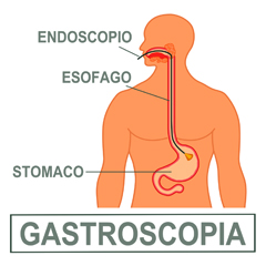 Gastroscopia