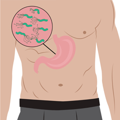 Infezione da Helicobacter pylori