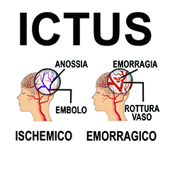 Ictus