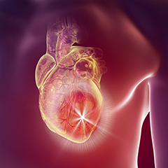 Angina pectoris