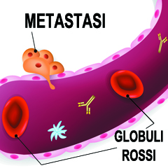 Metastasi