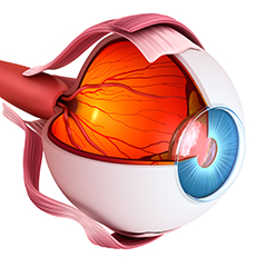 Neuromielite ottica (NMO)