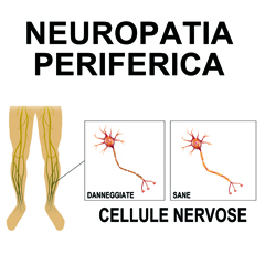Neuropatie periferiche