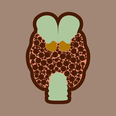 Noduli tiroidei