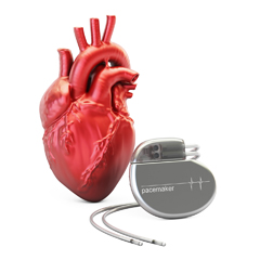 Pacemaker