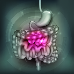 Sindrome dell'intestino irritabile