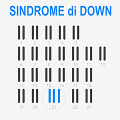 Sindrome di Down