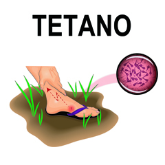 Tetano