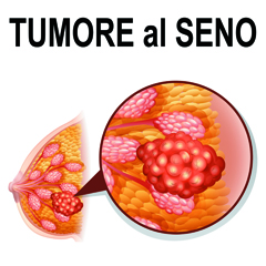 Tumore al seno