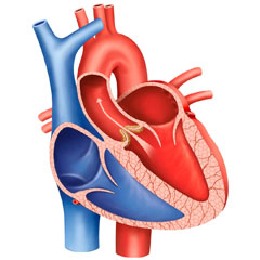 Malattie della valvola aortica